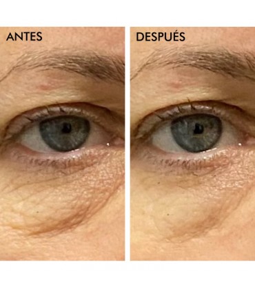 Parches Hidrogel para Ojos Awakening